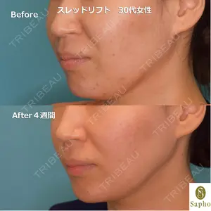 28 days after image