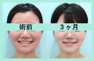 90 days after image