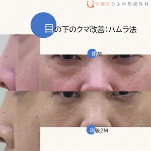 60 days after image