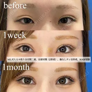 30 days after image