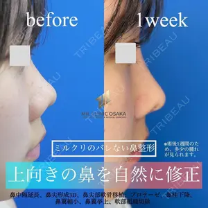 7 days after image