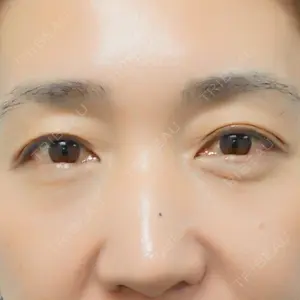 50 days after image