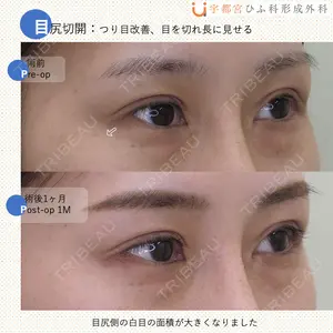 30 days after image