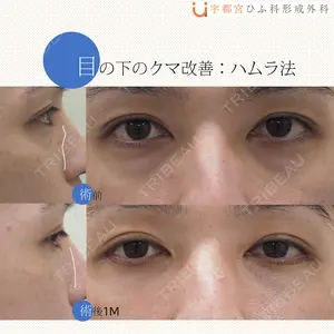 30 days after image