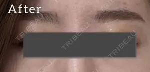 5 days after image
