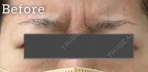 before image