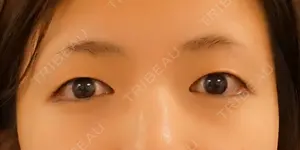 before image