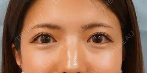 31 days after image