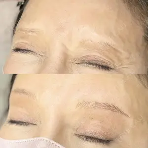 null days after image