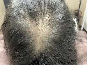 before image