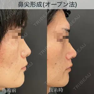 7 days after image