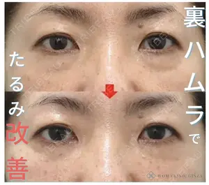 before image