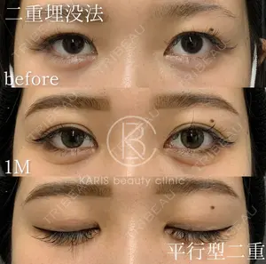 before image