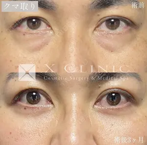 60 days after image