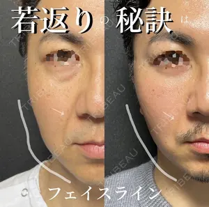 90 days after image