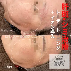 before image