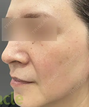 150 days after image