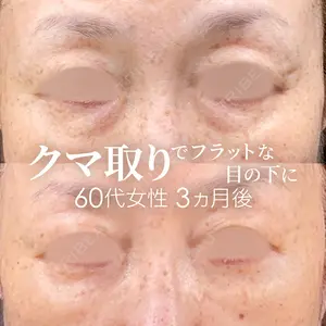 90 days after image