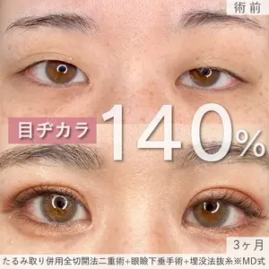 90 days after image