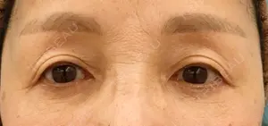 60 days after image