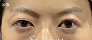 before image