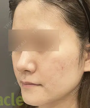 180 days after image