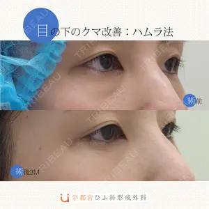 90 days after image