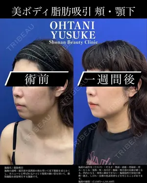 30 days after image