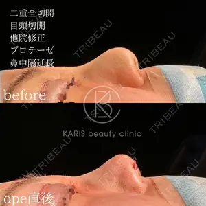 0 days after image