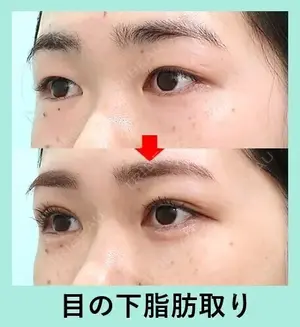 7 days after image