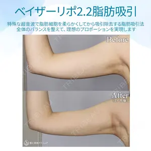 null days after image