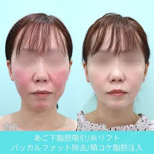 90 days after image