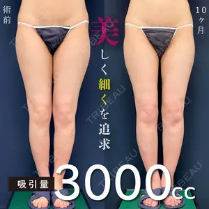 300 days after image