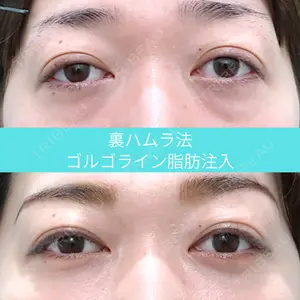 before image