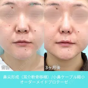 90 days after image