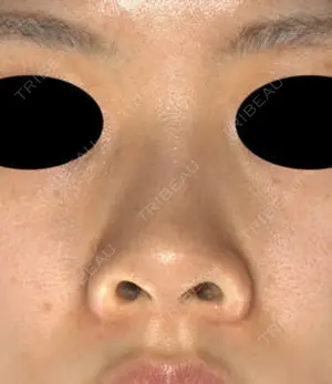 before image