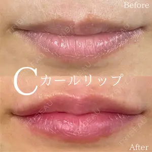 before image