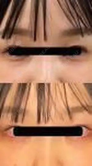 null days after image