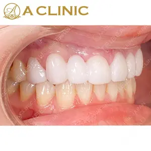 null days after image