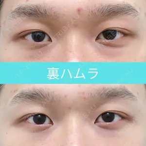 90 days after image