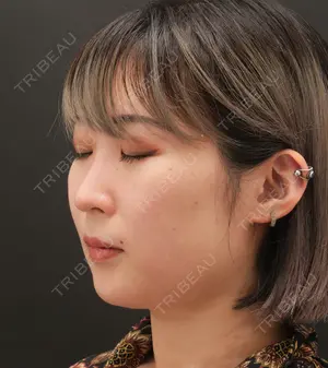 before image