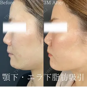 90 days after image