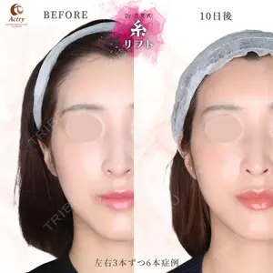 10 days after image