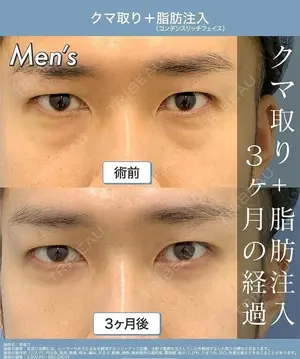 90 days after image