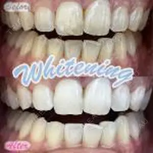 before image