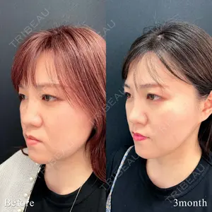 90 days after image