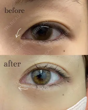 before image