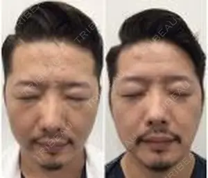 90 days after image
