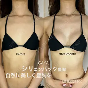 90 days after image