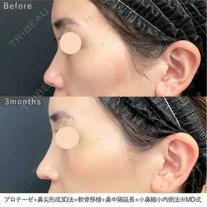 90 days after image